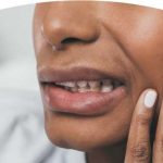 Stress can cause jaw and teeth issues