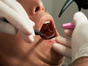 Gum Disease