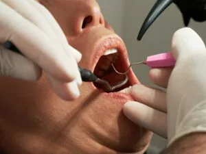 Gum Disease