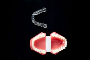 Invisalign Treatment