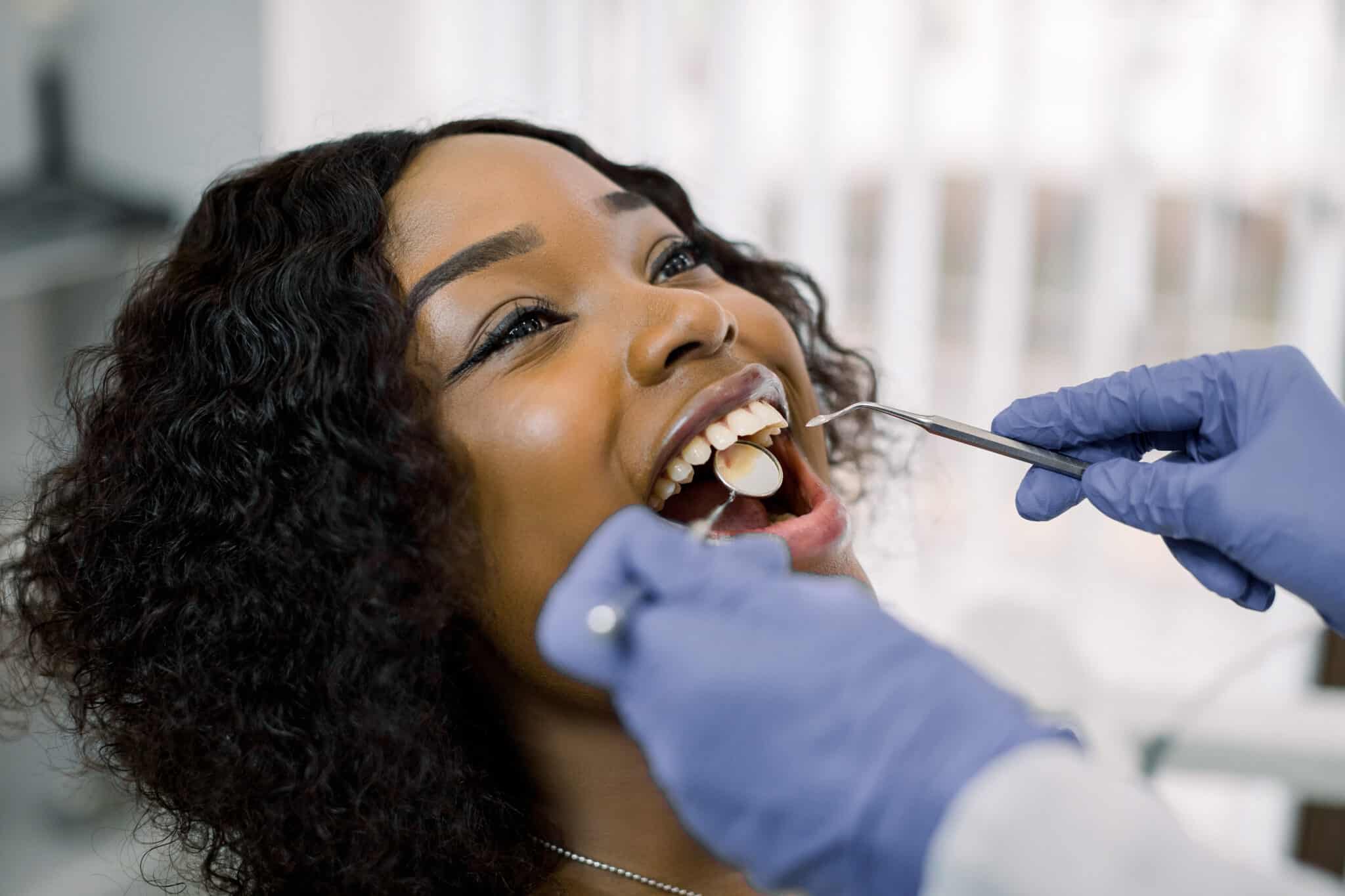 tooth-fillings-extractions-bite-dental-studios