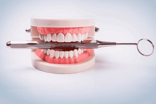 dental crowns